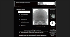 Desktop Screenshot of einterventionalradiology.com